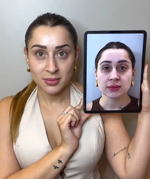 Paciente segurando um tablet com sua foto anterior ao tratamento, para comparação